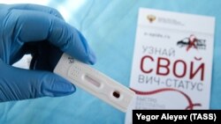 Адам ағзасында ВИЧ бар я жоғын анықтайтын тест. Көрнекі сурет.