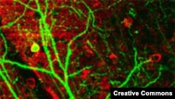 Нейрон головного мозга мыши подсвечен флуоресцентным зеленым белком.